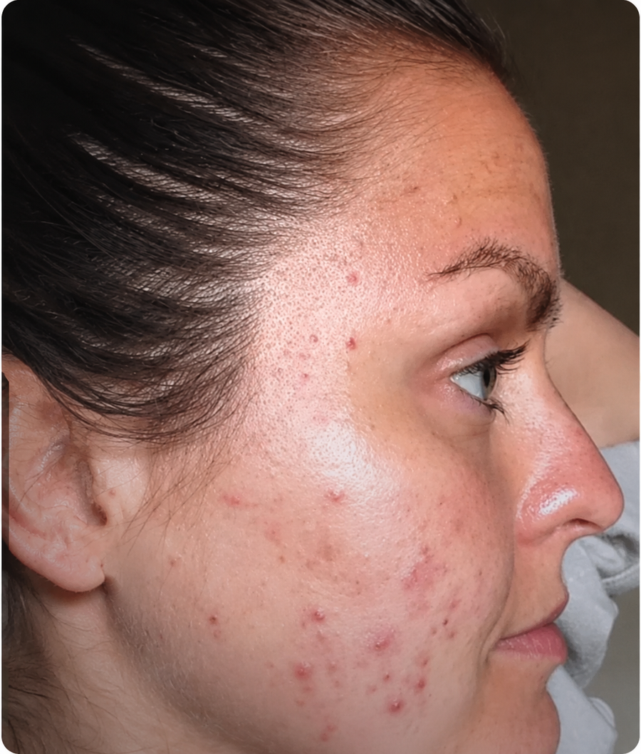 Truly radiant skin