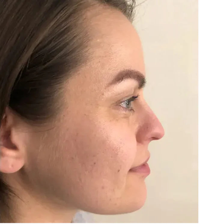 Truly radiant skin